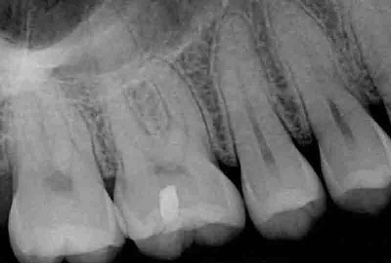 single-dental-x-ray-yuma
