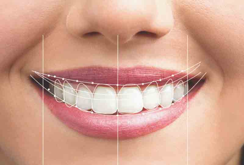 smile-design-yuma