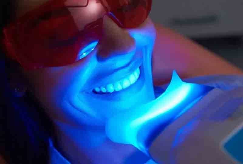 zoom-whitening-yuma