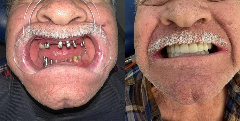 before-and-after2