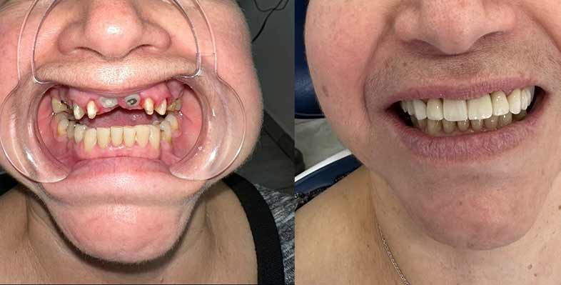 before-and-after3