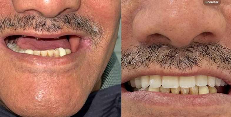 before-and-after4