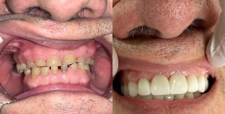 before-and-after5